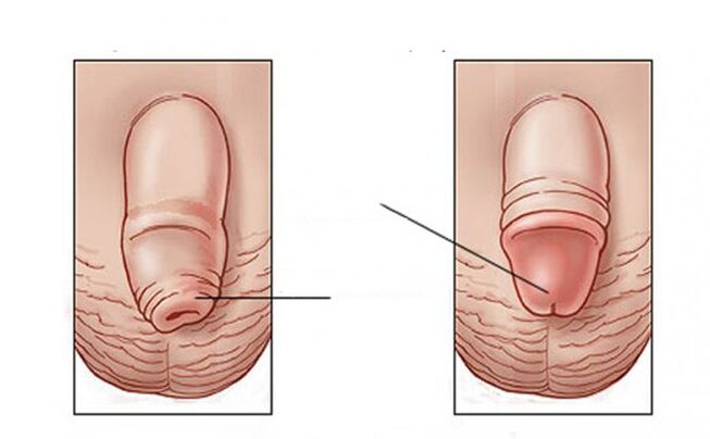 Que tarefa realiza o lubricante